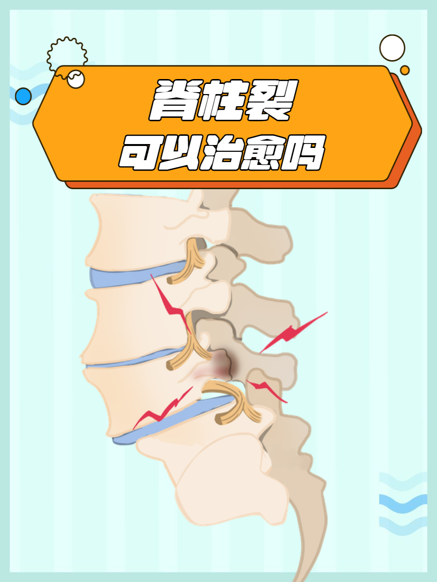 在临床上脊柱裂是一直备受关注的疾病,因为脊柱裂不仅会