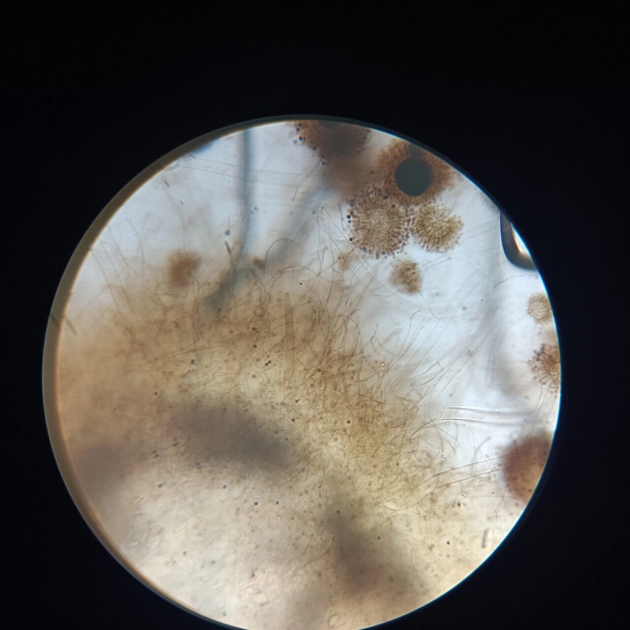 曲霉显微镜下图片