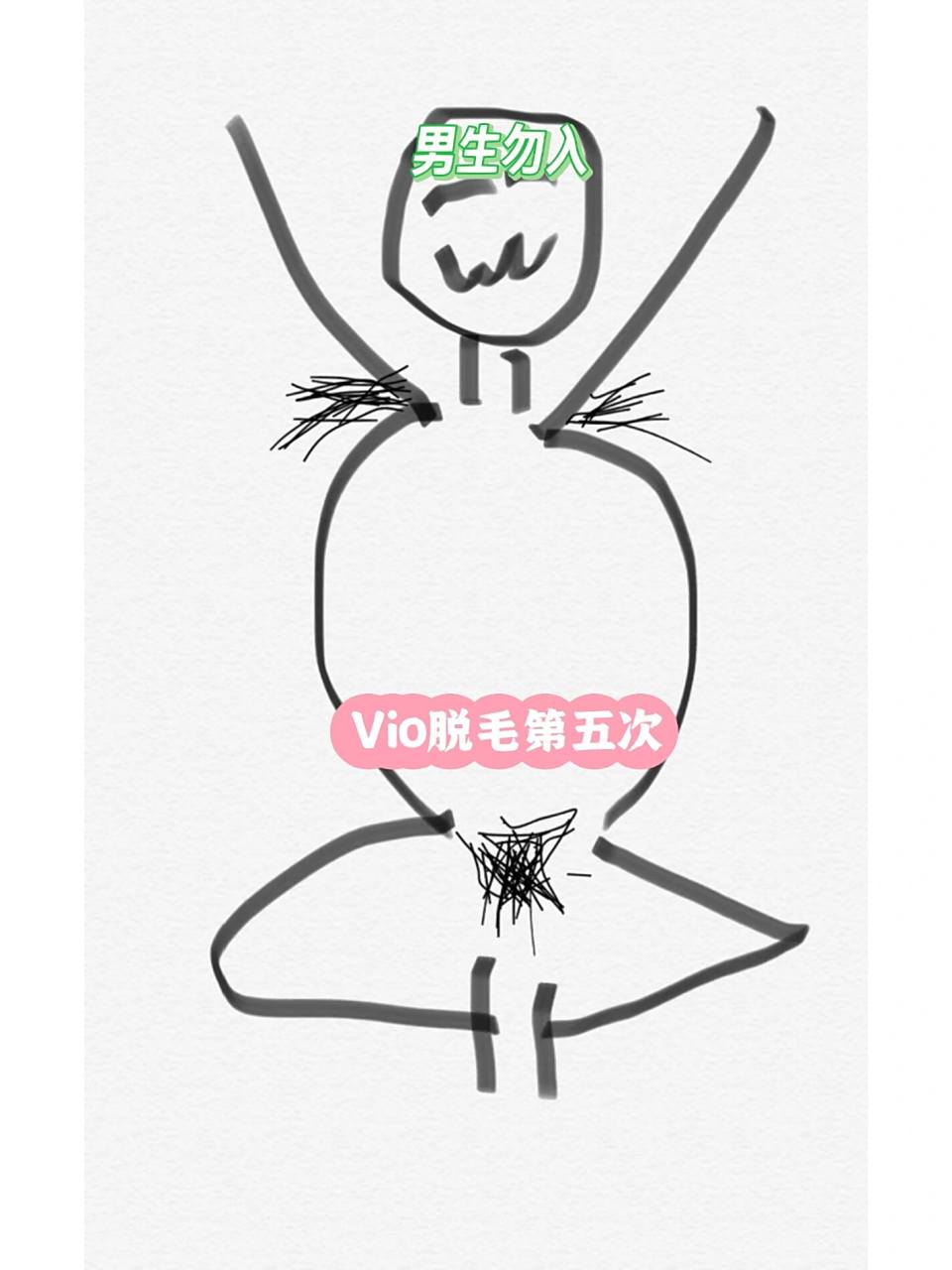 脱毛都社死大型现场 脱光衣服穿个抹胸 手举平腋下脱毛, 比基尼脱毛脚