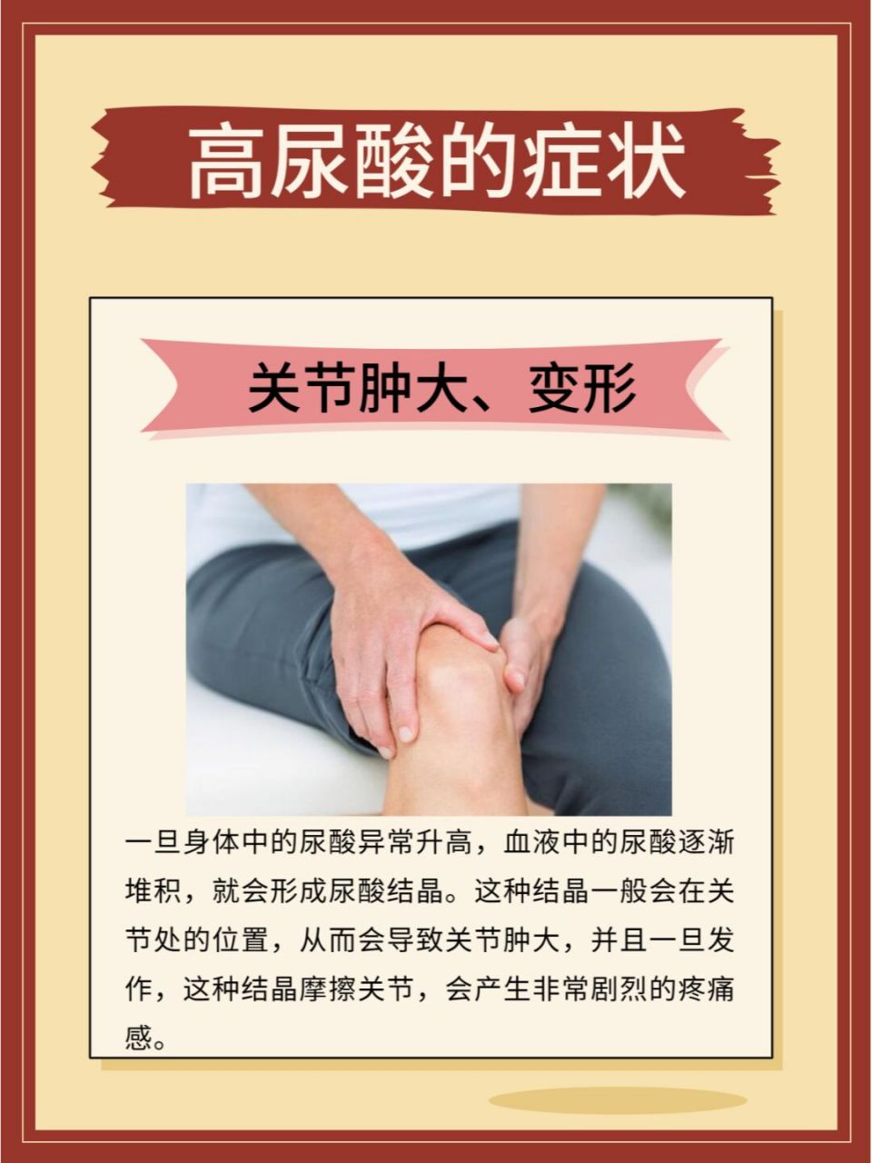 高尿酸有哪些症状表现 1.