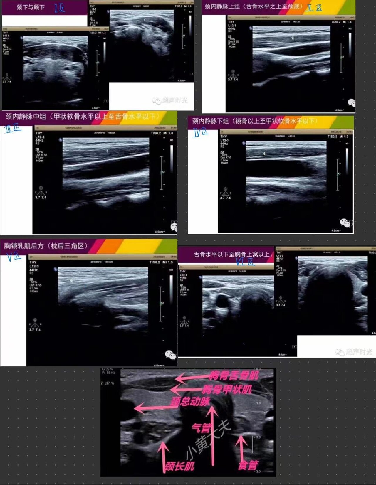 甲状软骨超声图像图片