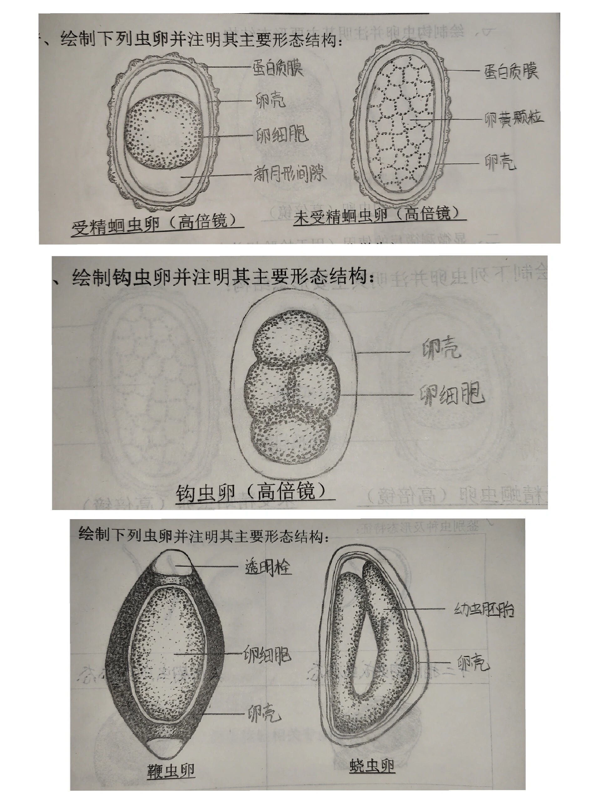 肠吸虫卵手绘图片图片