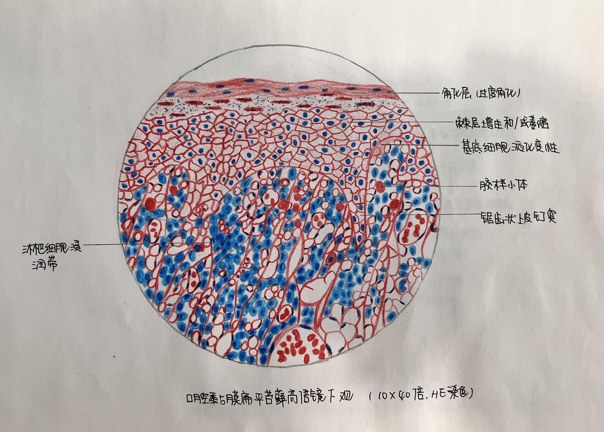 口腔组织病理学 92口腔黏膜扁平苔藓 92慢性牙周炎活动期牙槽骨