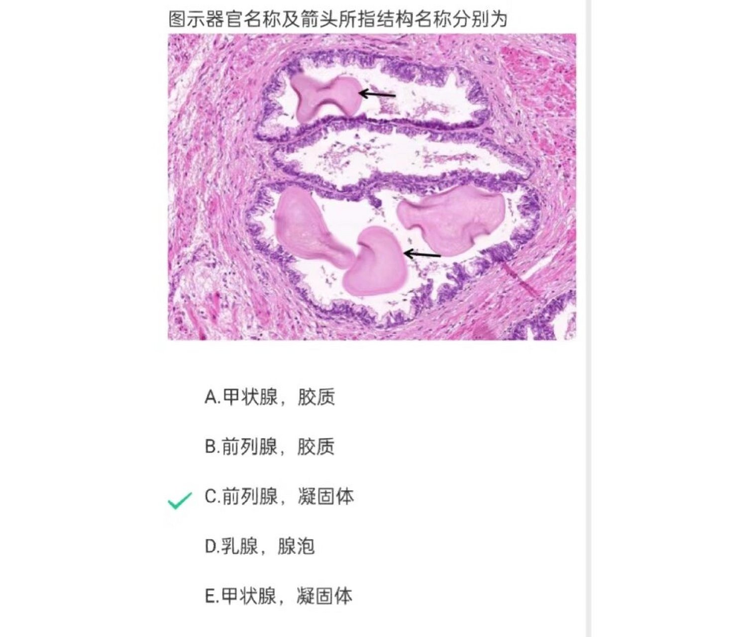 组胚重点切片观察:男性生殖系统 图三(生精小管光镜图):a.支持细胞b.