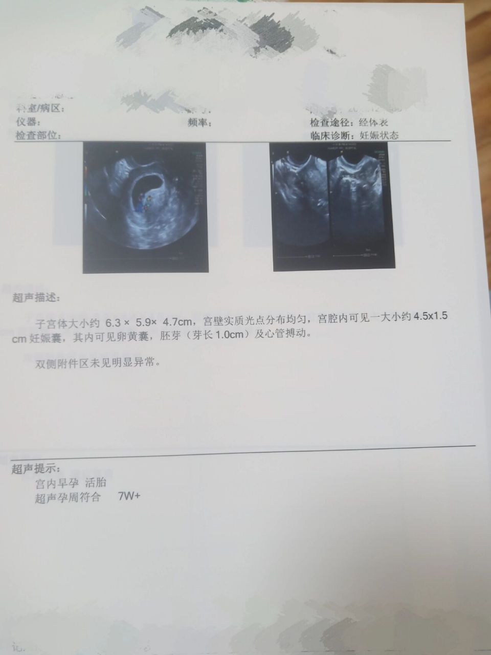 阴超 怀孕图片