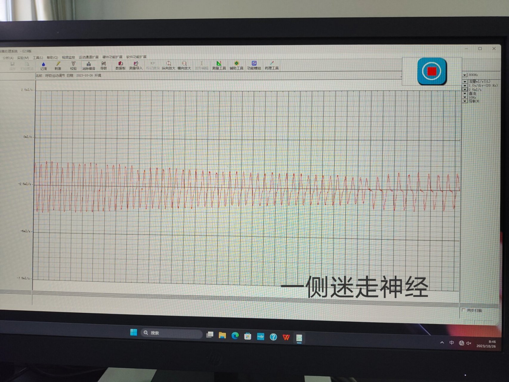 家兔正常血压曲线图图片