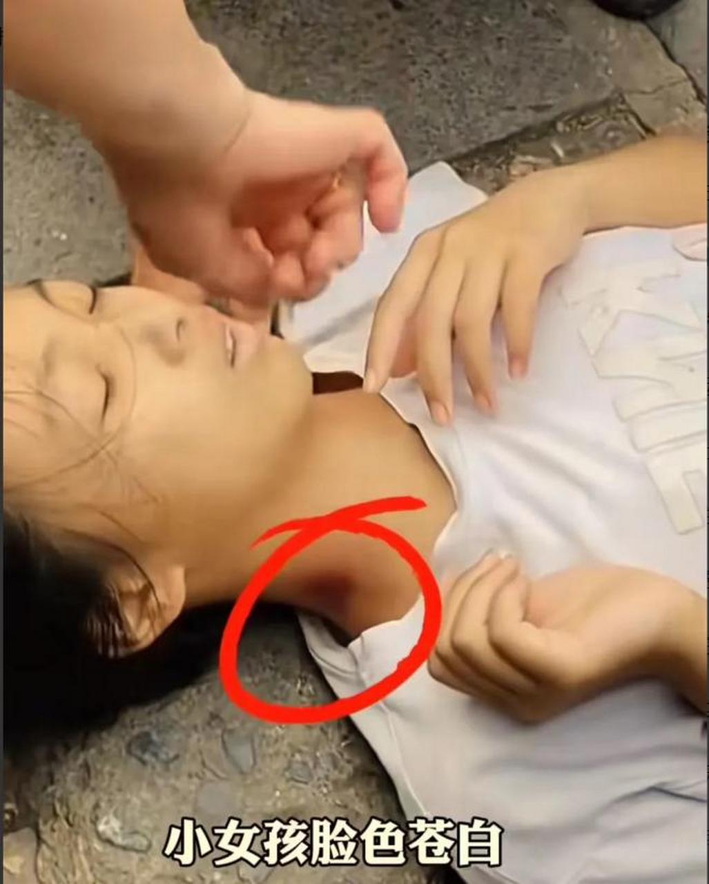 重庆,小女孩路边中暑晕倒,却无人敢扶!