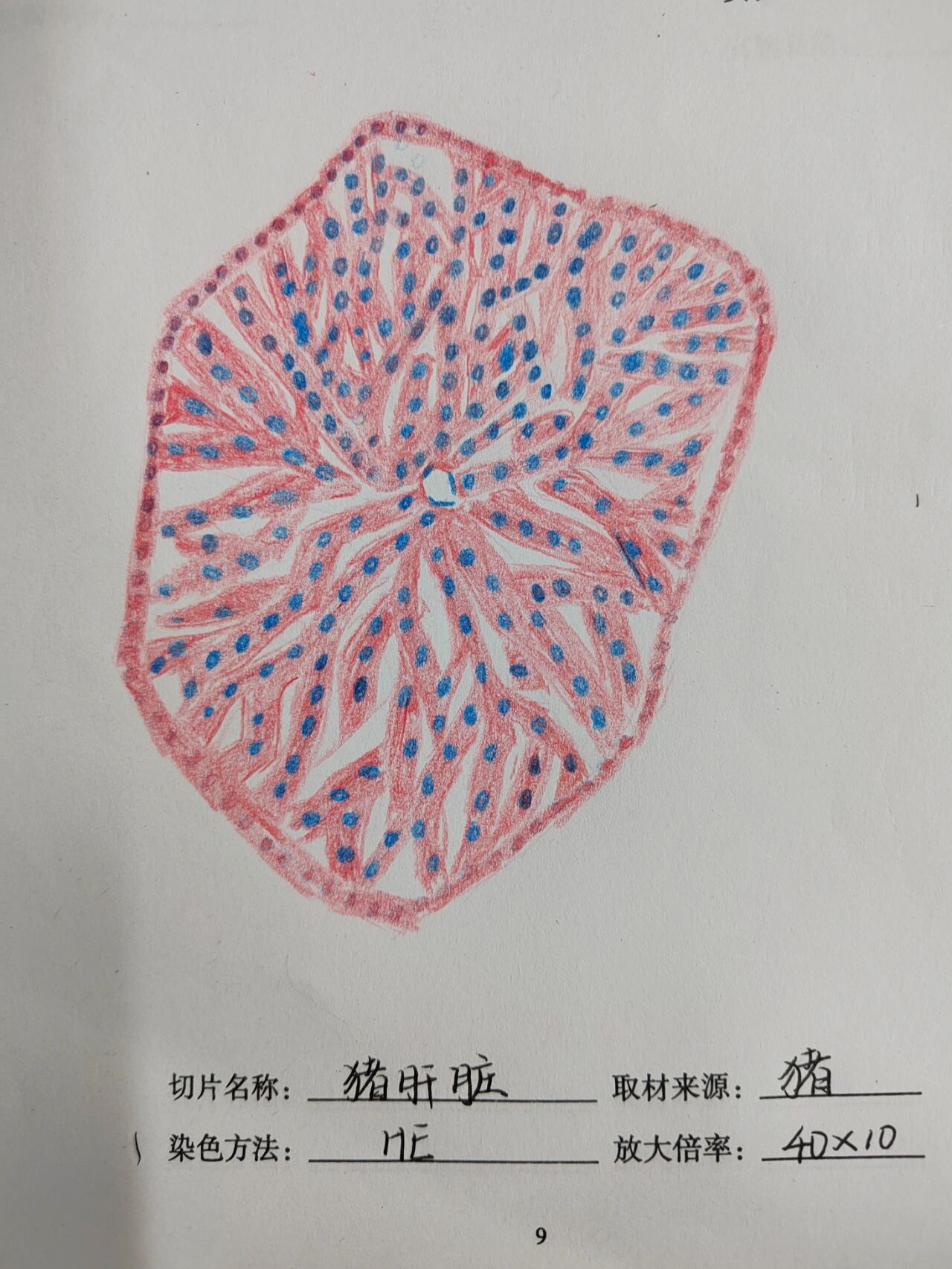 甲状腺红蓝铅笔绘图图片