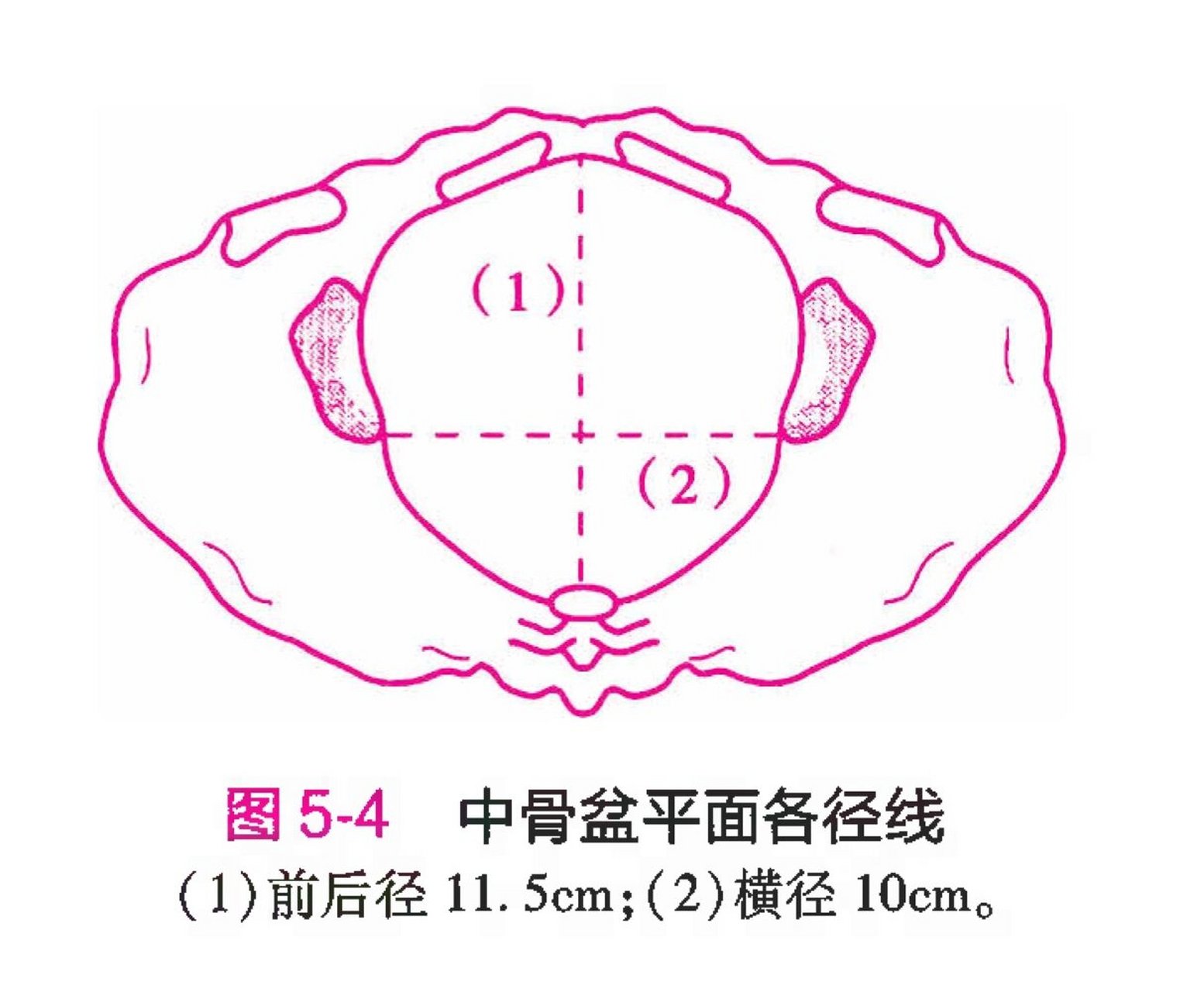 骨产道中骨盆平面图片