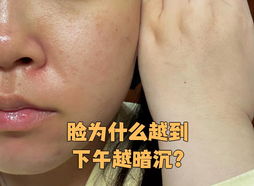 人为什么会被晒黑