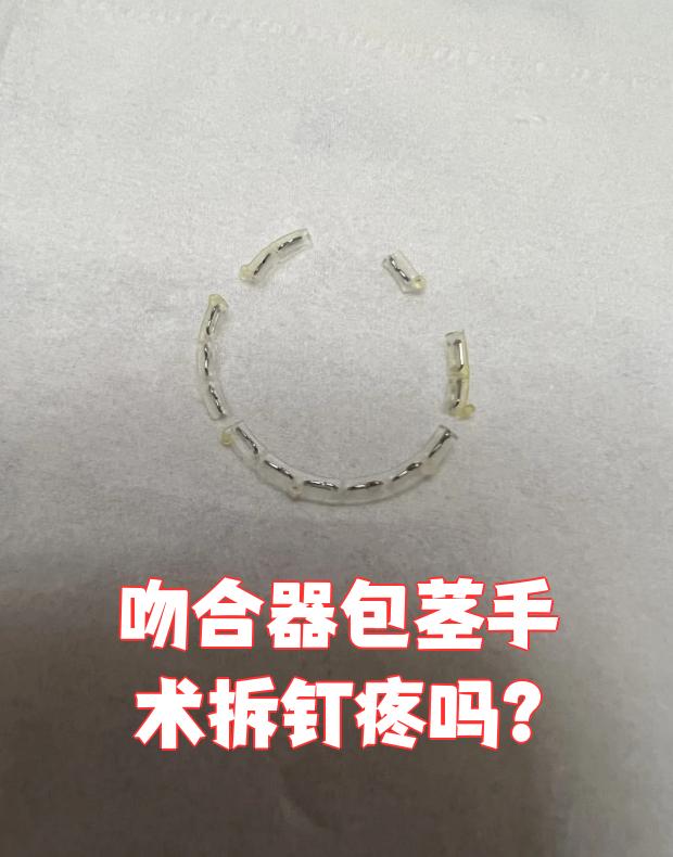 吻合器包茎手术拆钉时会有一定疼痛感,但具体感觉因人而异
