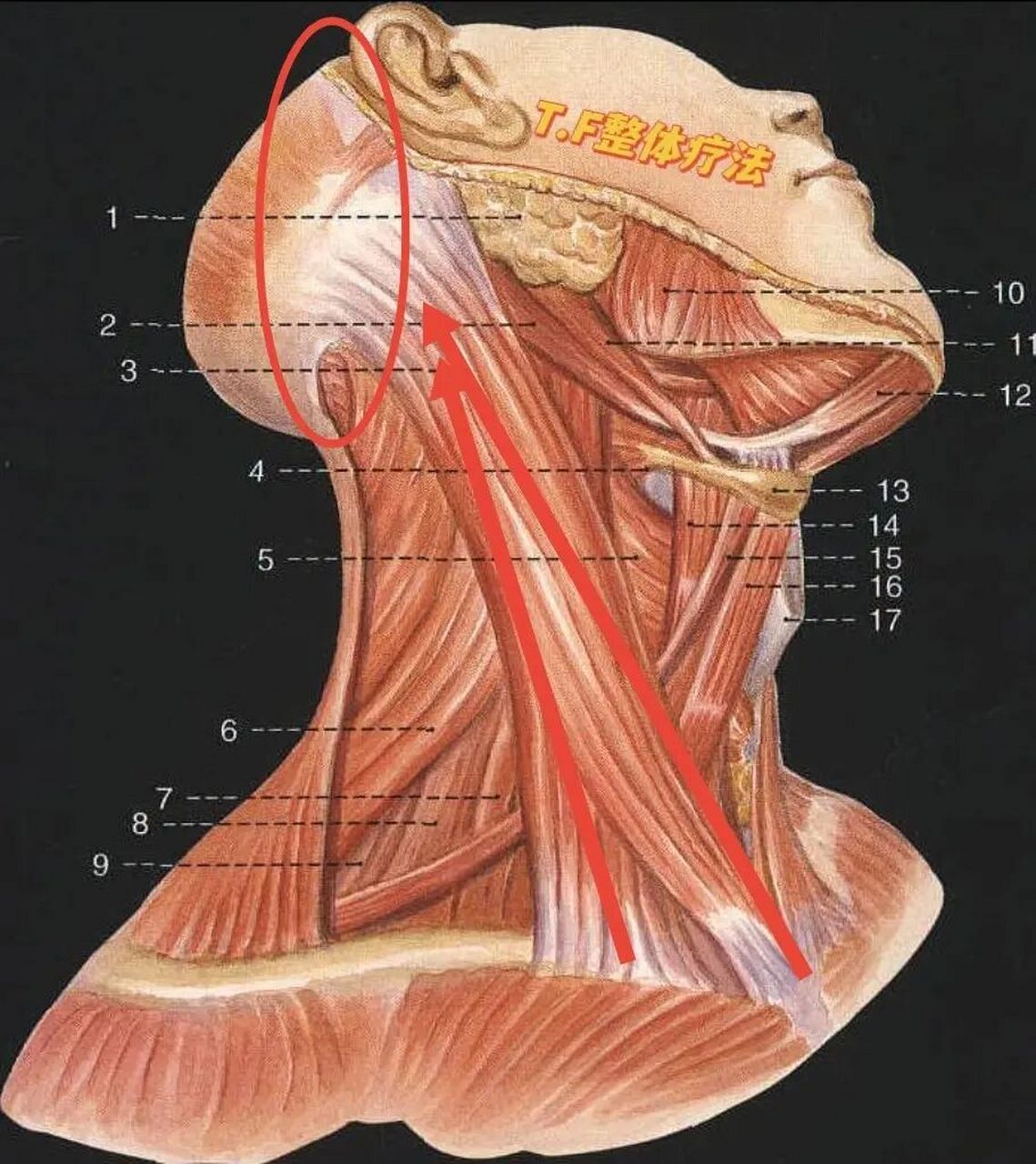 乳突位置示意图图片