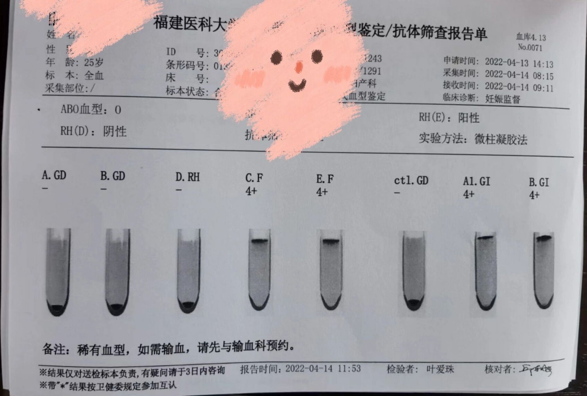 熊猫血化验单图片正常图片