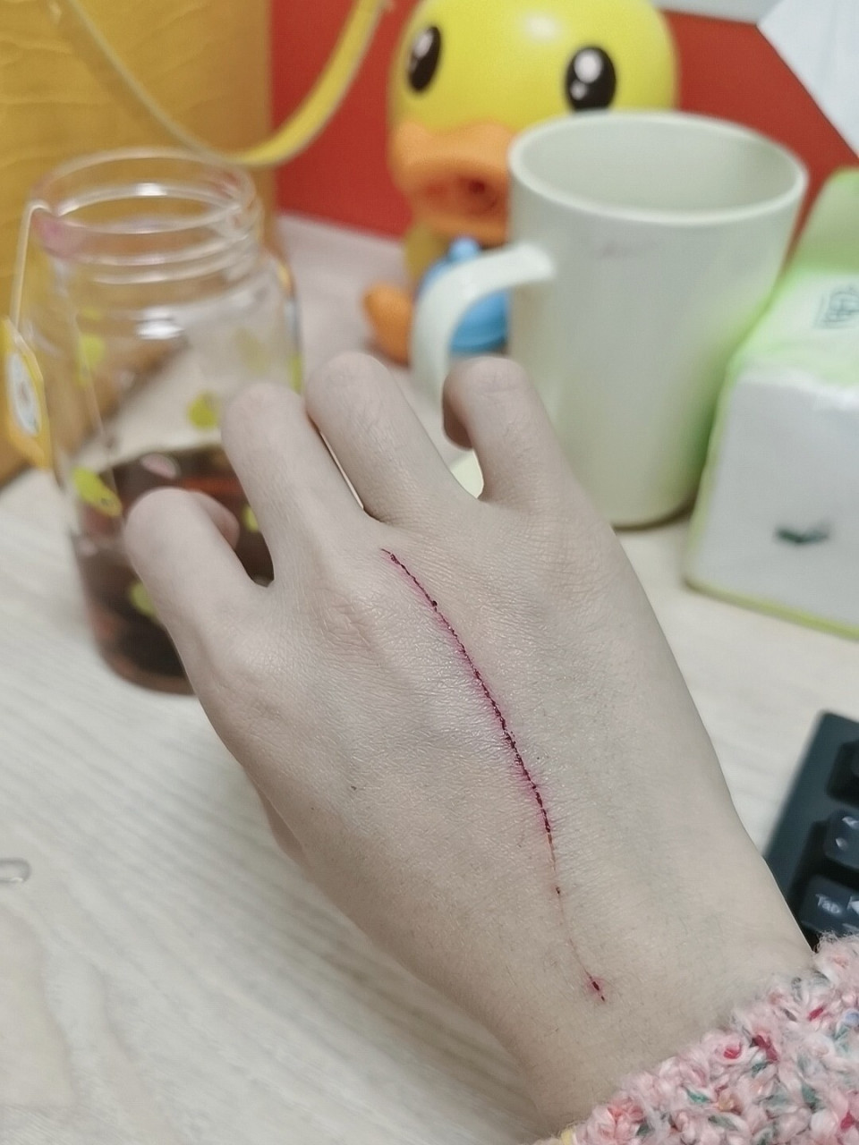 被家养猫咪抓伤了要去医院打针吗?
