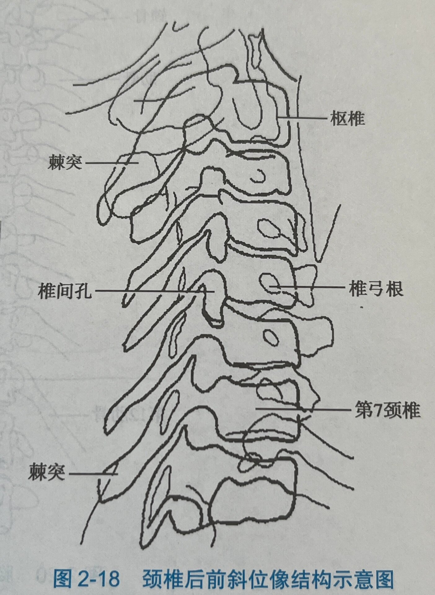 荐椎部原始点图片