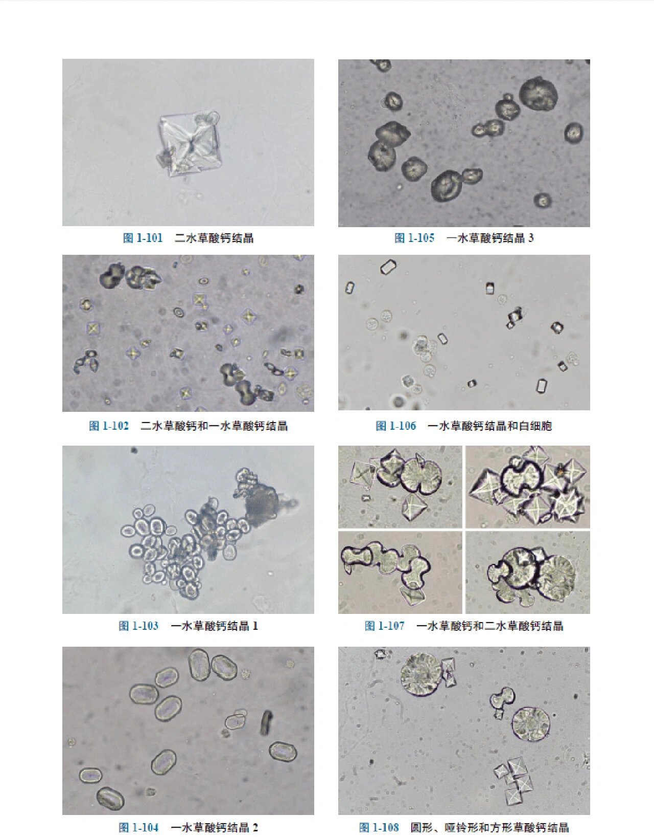 草酸钙结晶——超全高清体液图谱 →	 🍀 	 草酸钙结晶多呈无色或淡