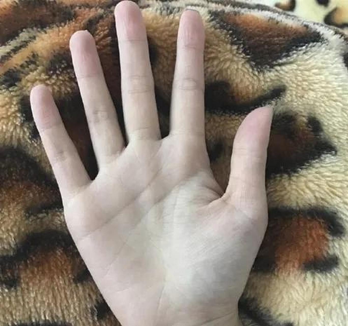 但有的人手掌无论是翻还是覆,都是无名指比食指长,要么无名指比