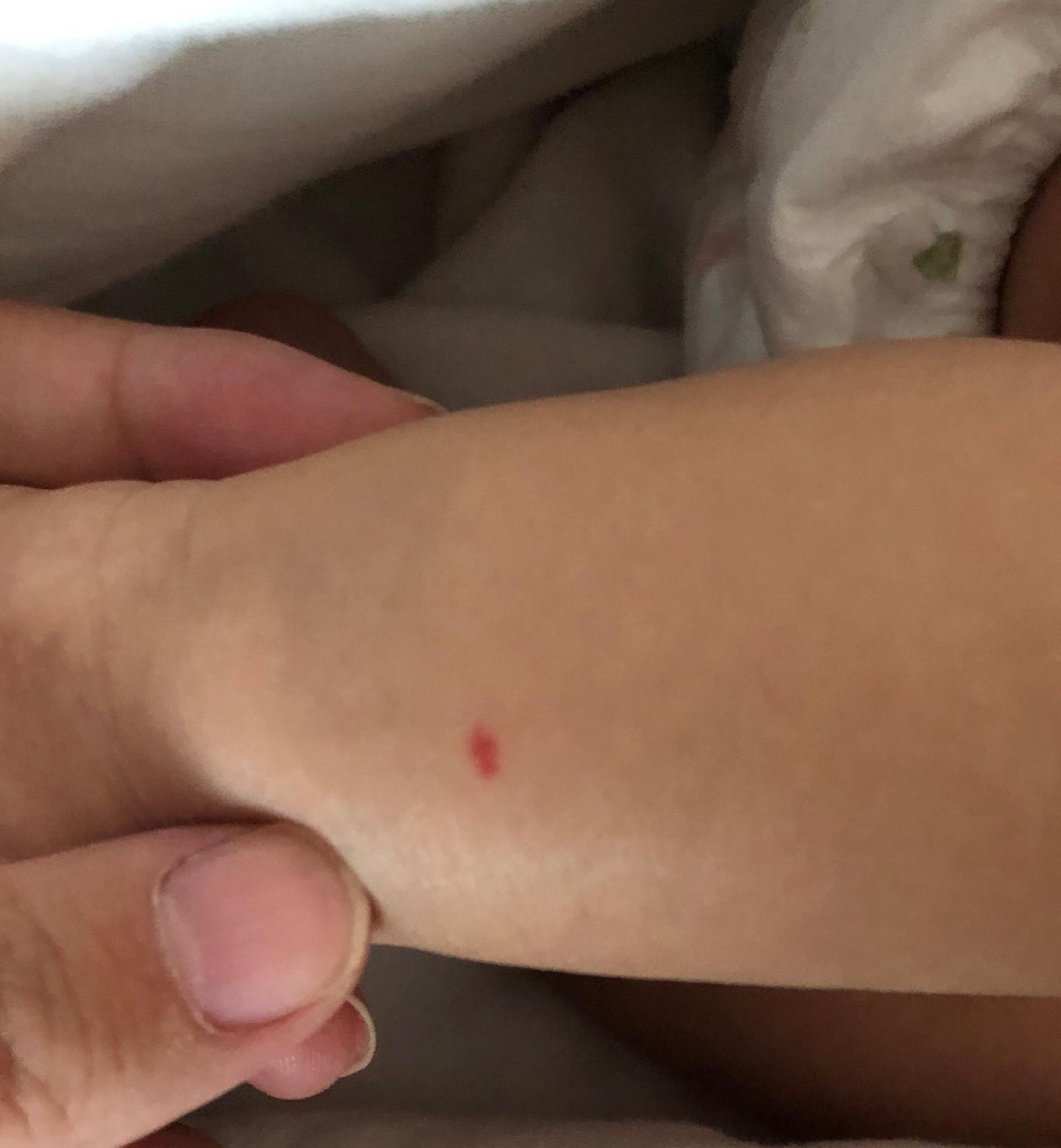 宝宝身上有小红点 这是什么