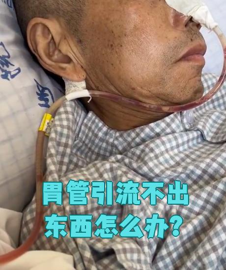 常见原因有三种:胃管被堵住,胃管位置不对,负压引流装置出问题