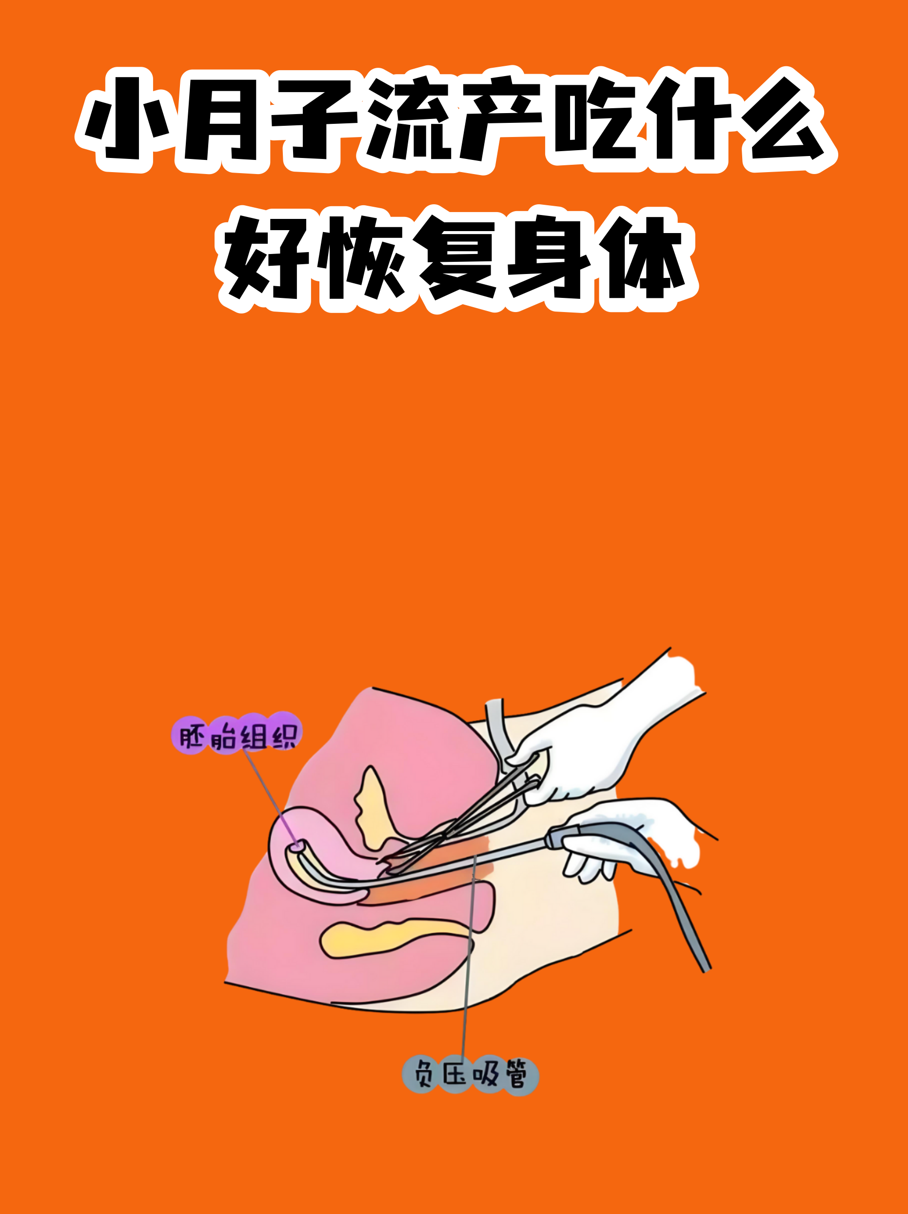 友谊医院预约检查陪诊挂号出院居家护理提醒，科学恢复身体的简单介绍