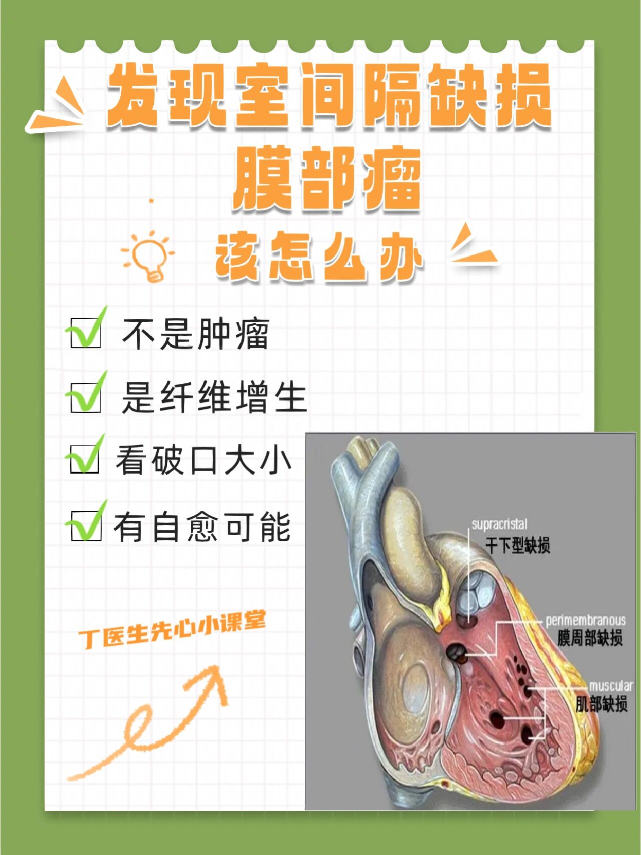 宝宝发现室间隔缺损膜部瘤该怎么办?