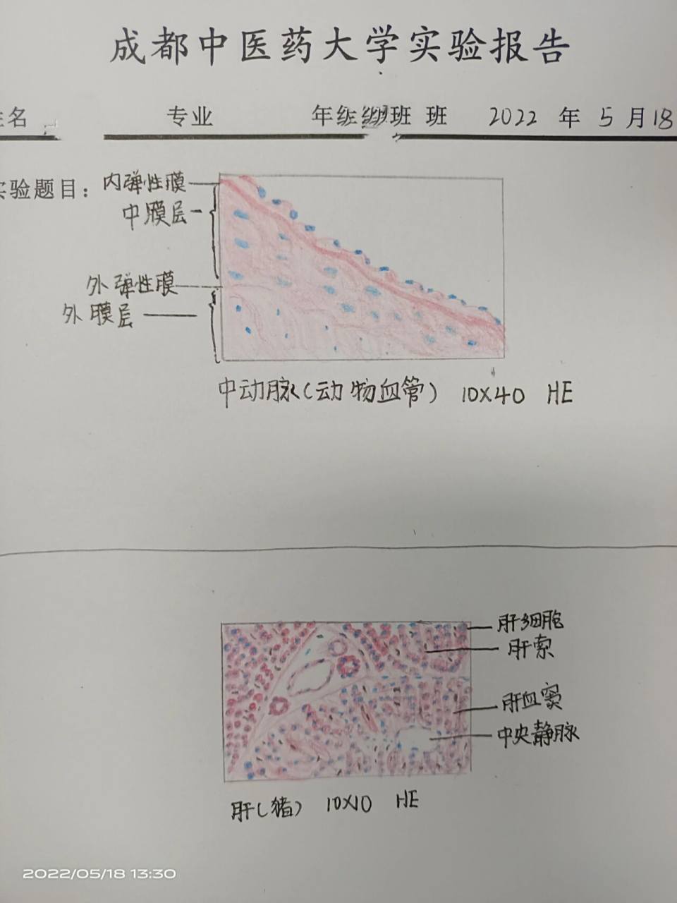 中动脉,肝,红蓝铅笔手绘图 中动脉,肝,红蓝铅笔手绘图