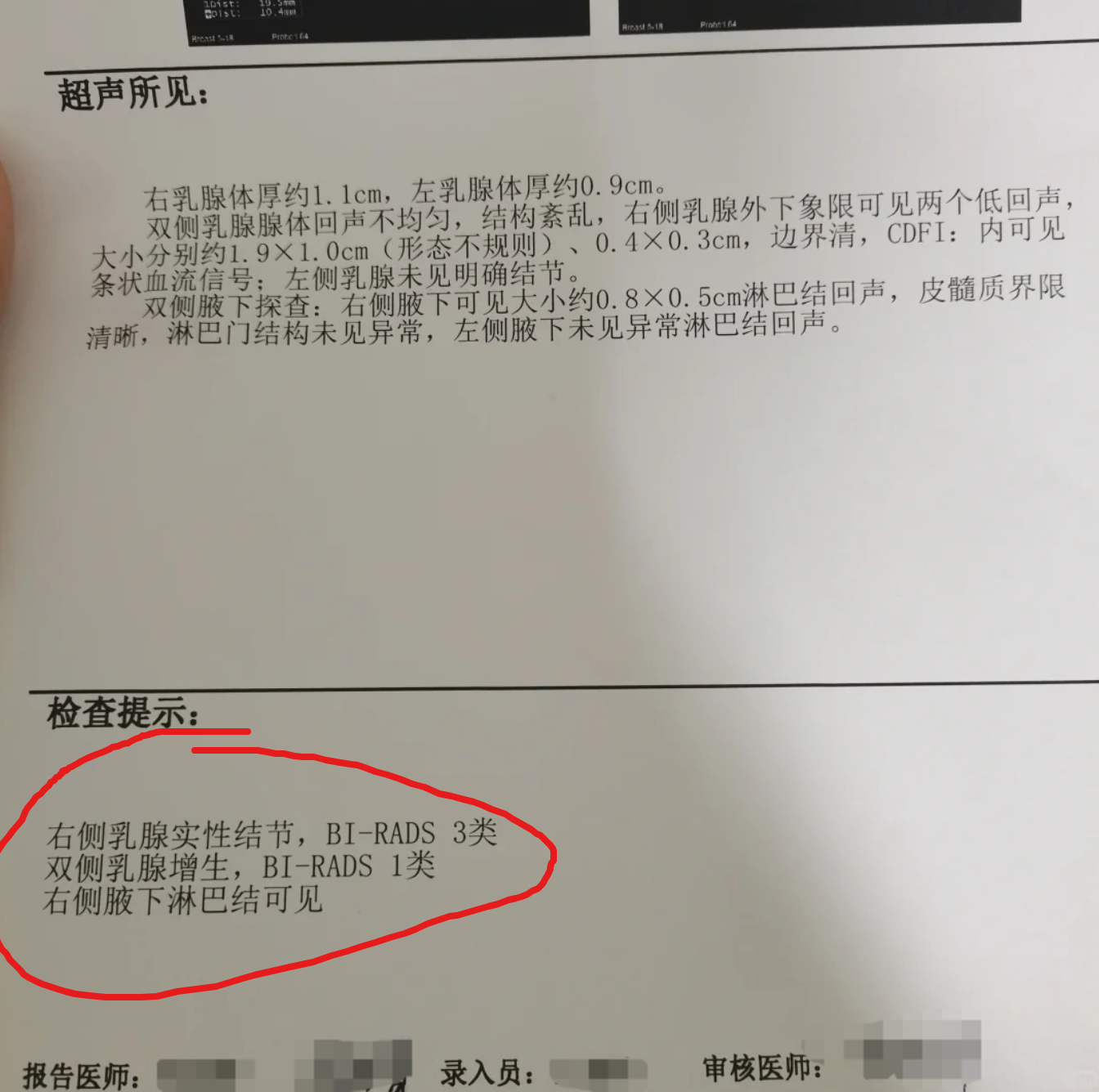 乳腺bi-rads 3类是通过乳腺彩超检查对乳腺增生情况的分级结 .