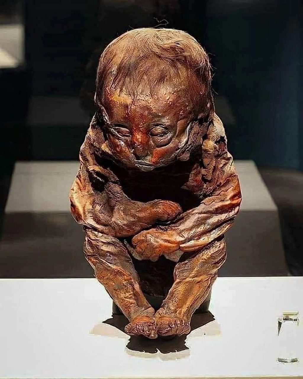 来自德特莫尔德的男孩  这是在秘鲁安第斯山脉发现的一具婴儿木乃伊.