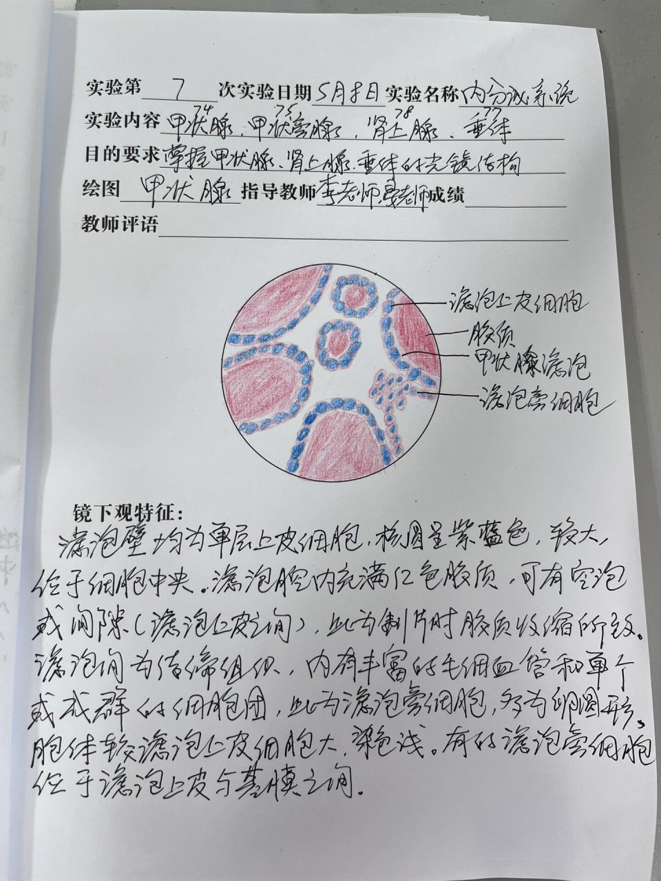 组织与胚胎学甲状腺实验报告 甲状腺红蓝铅笔绘图