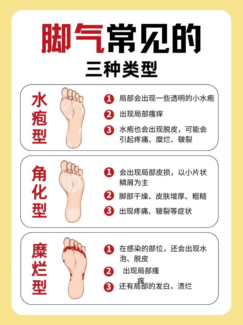 04水疱型 04角化型 04糜烂型 脚气不会自愈,一旦出现任意一种