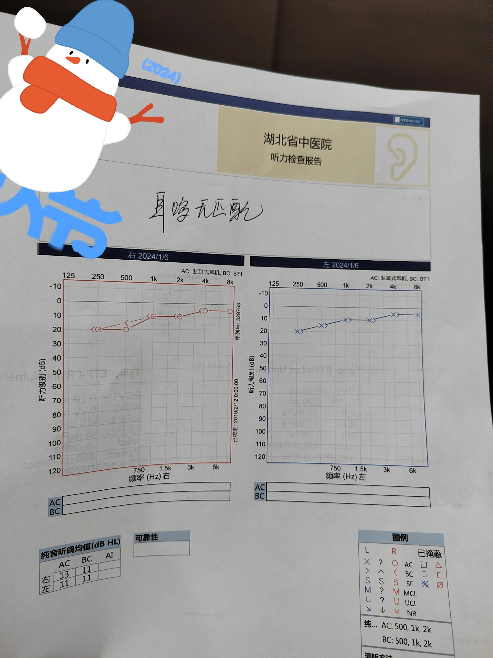 花235来做的听力检查 耳鸣有一段时间了 不是天天耳鸣 就是有的时候