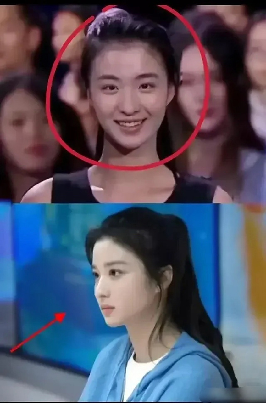 有人拿了王楚然以前的照片来做对比,说她动刀了.