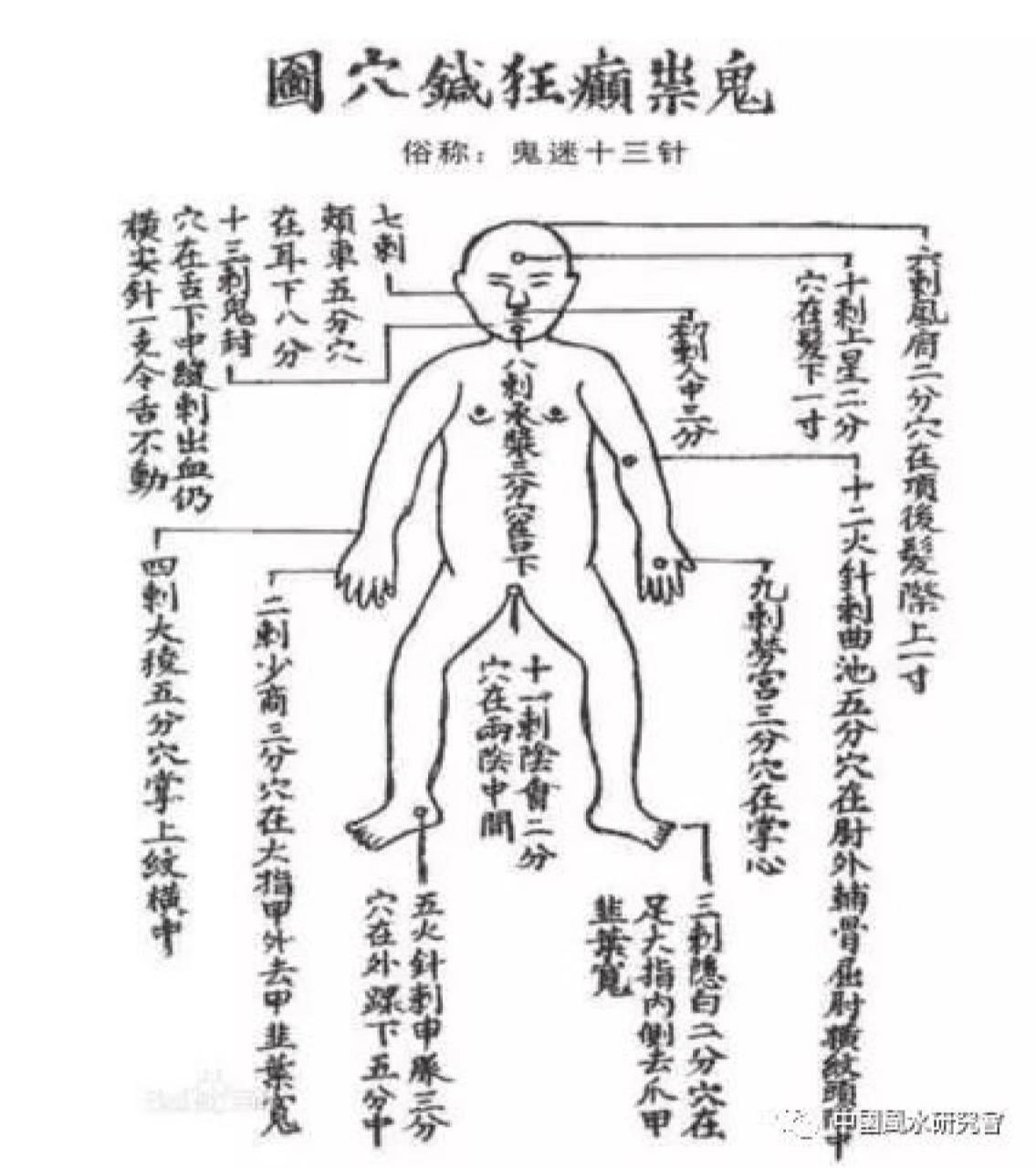 鬼门十三针歌诀,一针人中二少商 《鬼门十三针歌诀》 一针人中二少商