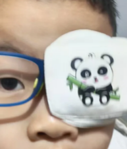 眼睛不对焦有可能是斜视,但也可能是其他问题,具体要看情况