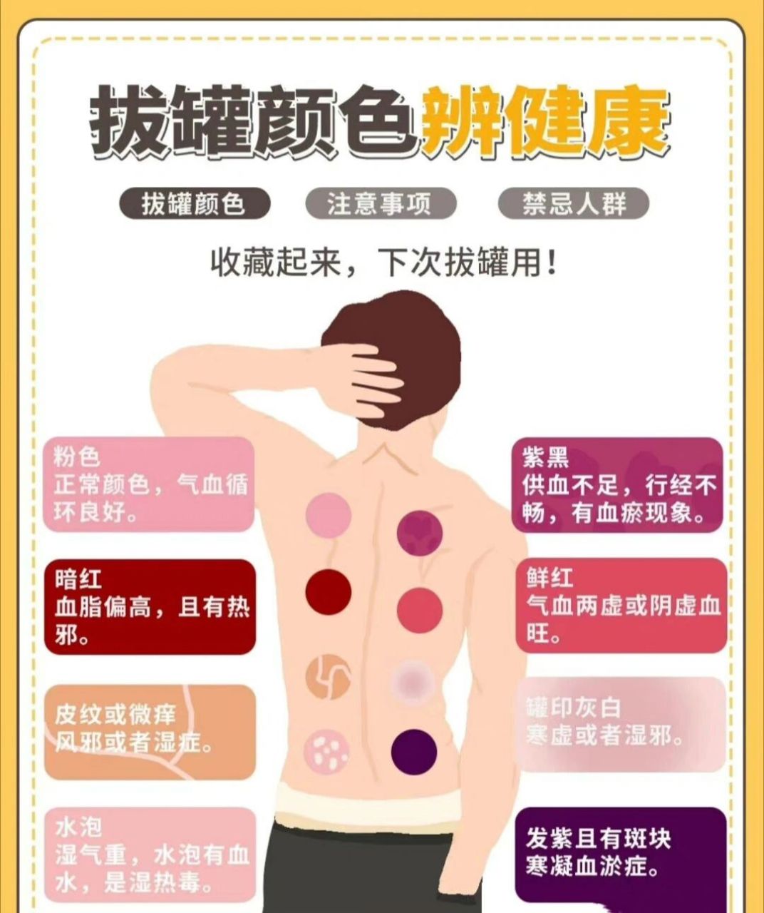 拔罐颜色辨健康 拔罐颜色辨健康 #拔罐# #健康科普# 健康 #健康养生