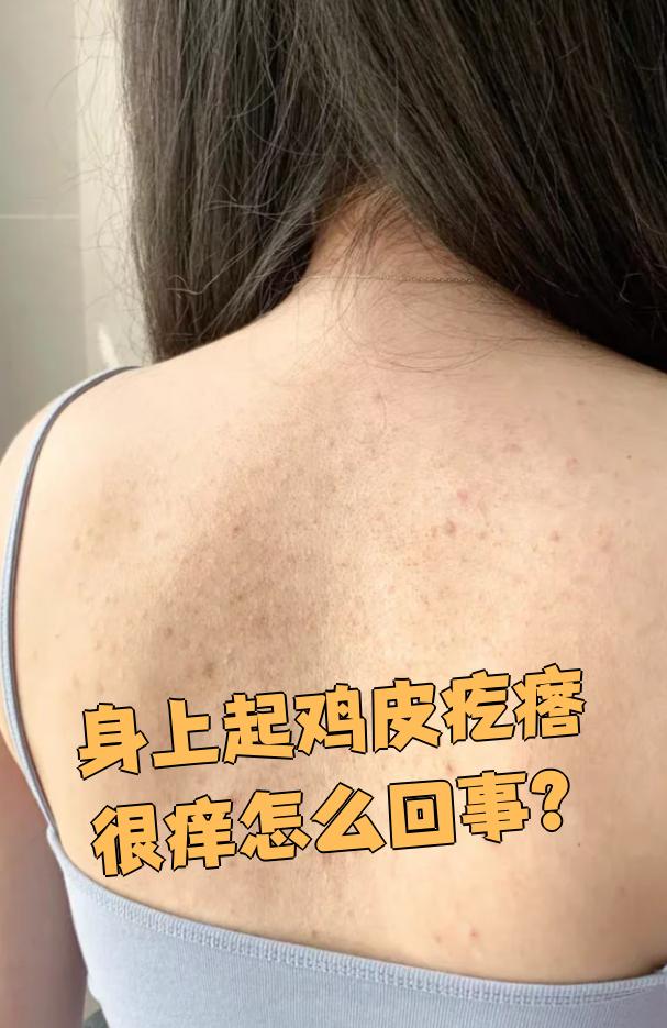 身上为什么会痒 身上为什么会痒