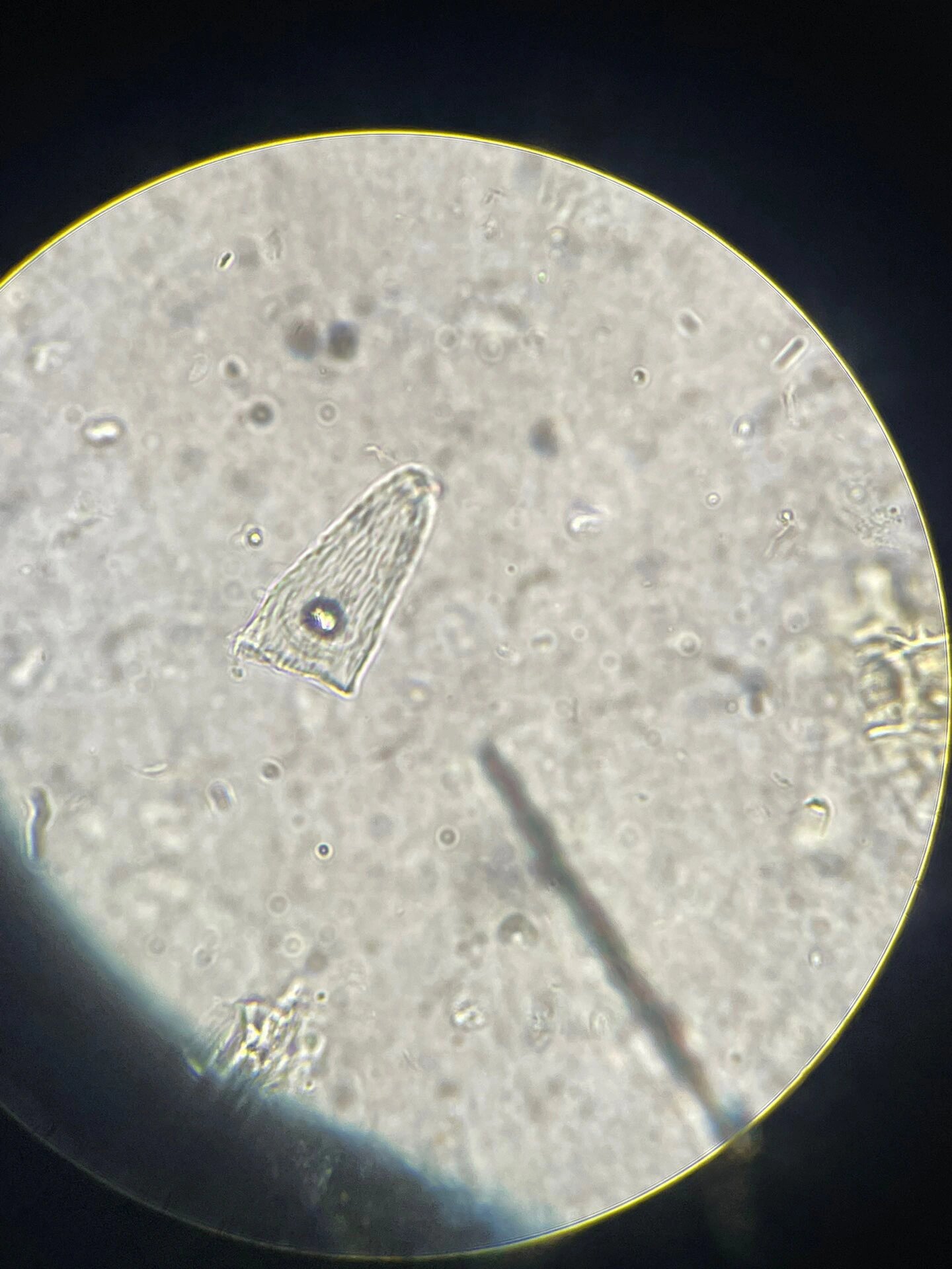 穿心莲粉末显微图 晶细胞:含大型螺样钟乳体,较大端有脐样点痕,层纹波