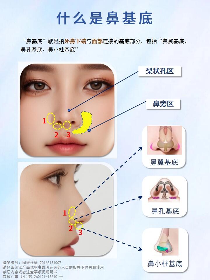 鼻综合手术是什么
