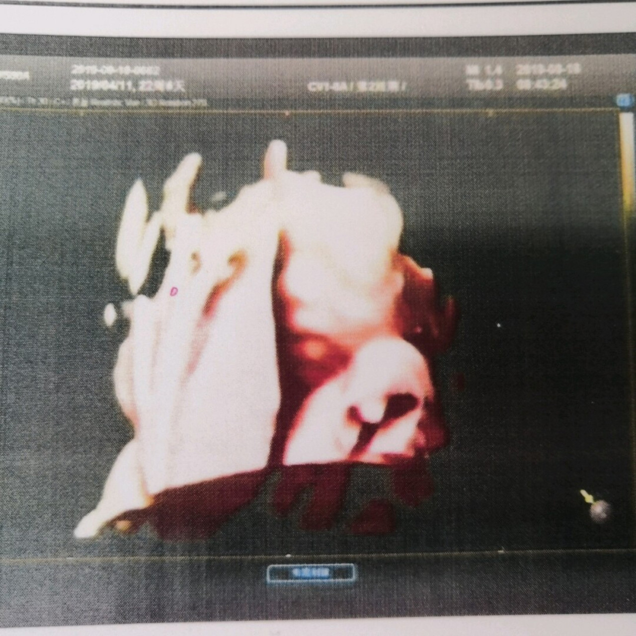 四维彩超顺利通过 22周 4预约到了四维彩超,宝宝还算配合,两次做完的