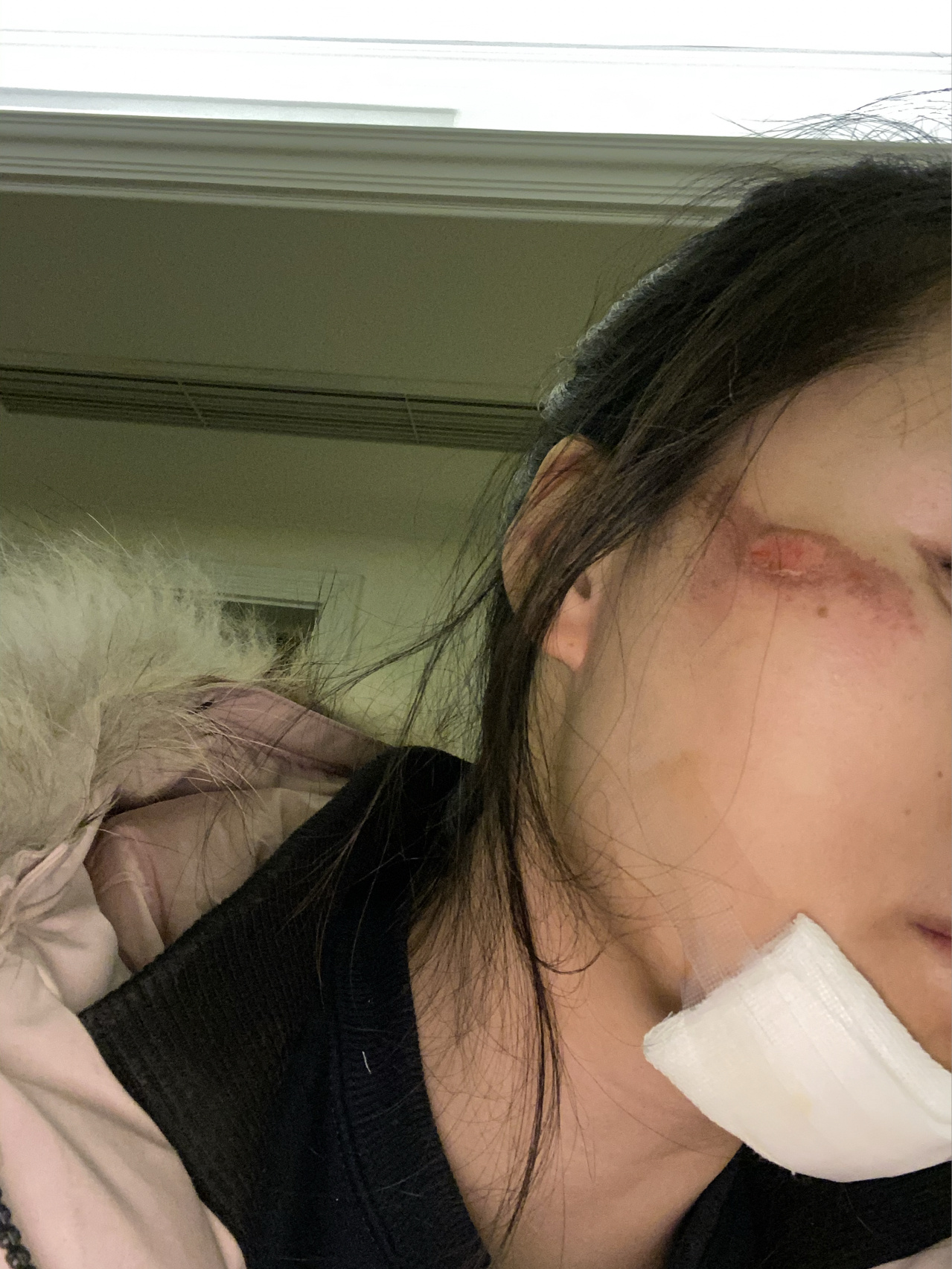 脸部擦伤怎么办?皮肤变黑求推荐复原办法