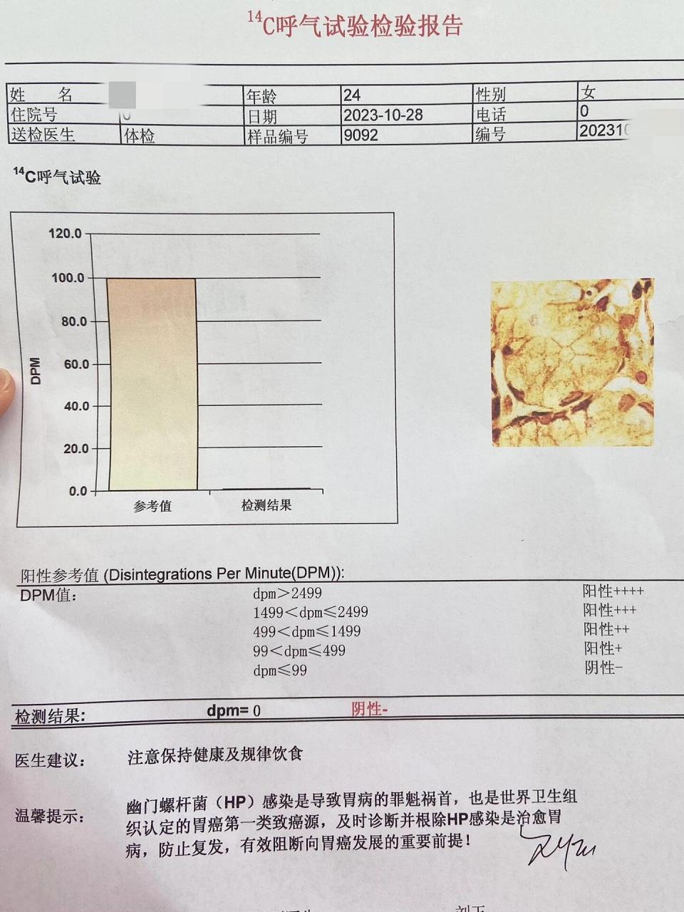 碳14阳性图片