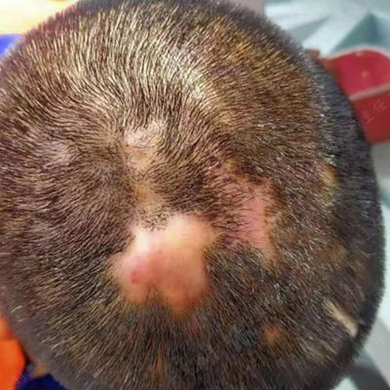 记得当时他头上一个鸡蛋大小的脓包(图1),头发稀疏.