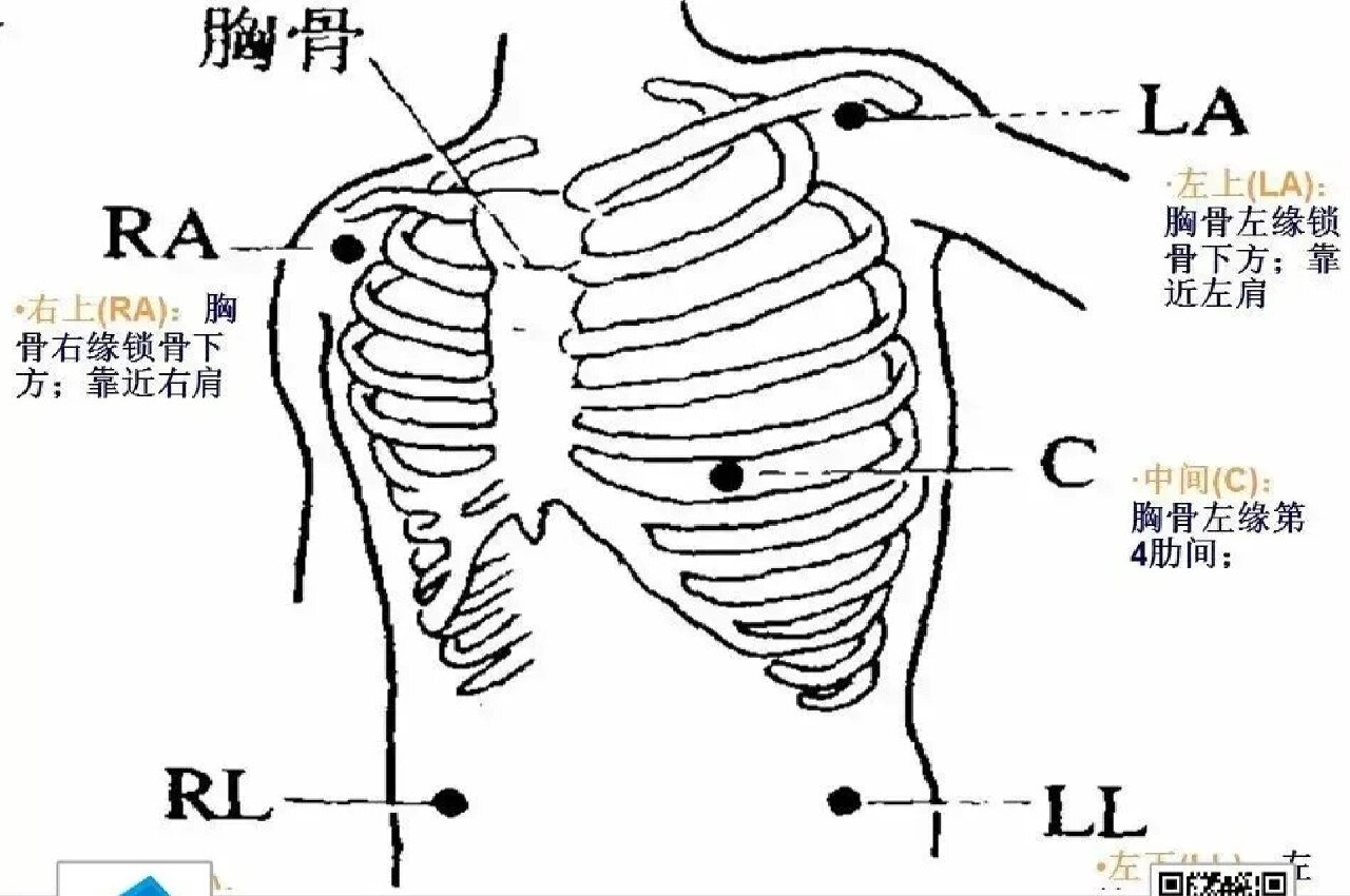 心电监护仪位置图图片