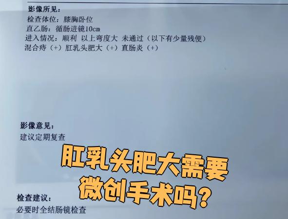 肛乳头肥大是否需要微创手术,取决于患者的具体病情