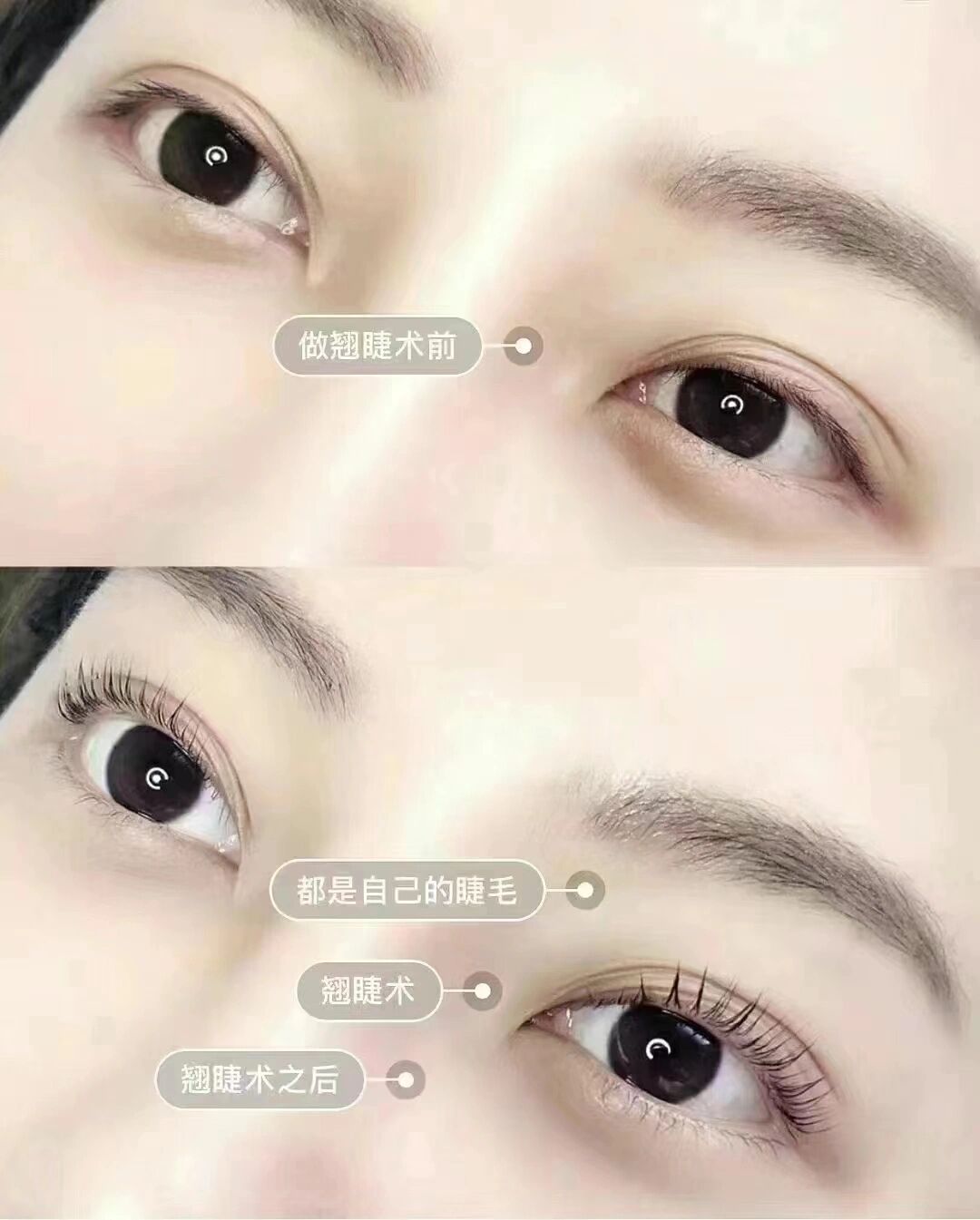 首先说说市面上几种针对睫毛的技术: 166睫毛嫁接术(假睫毛佩 ))