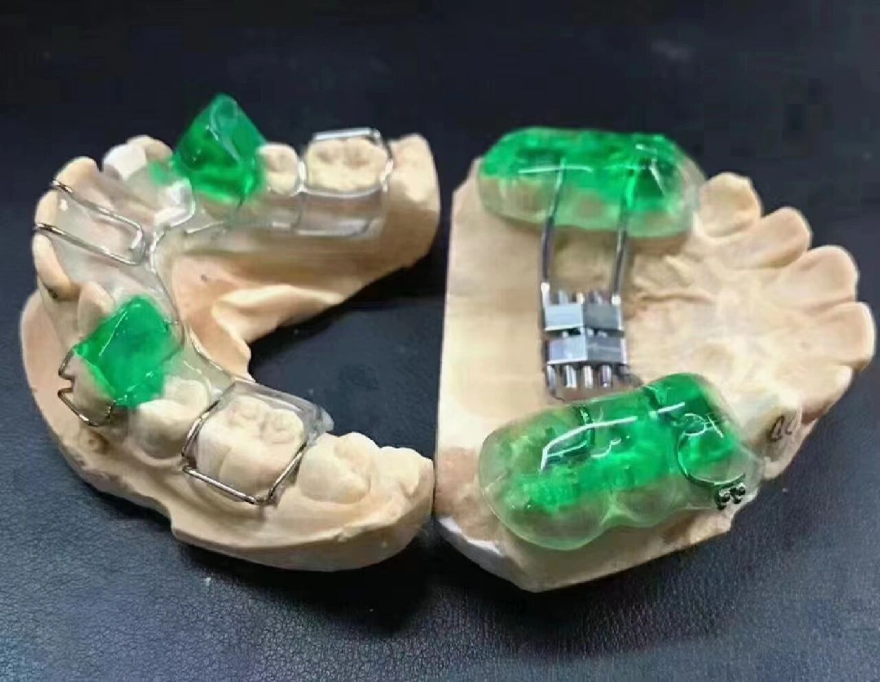 牙齿矫正 sgtb矫正器 也称双导面矫正器77快速扩弓器 适合12～20岁