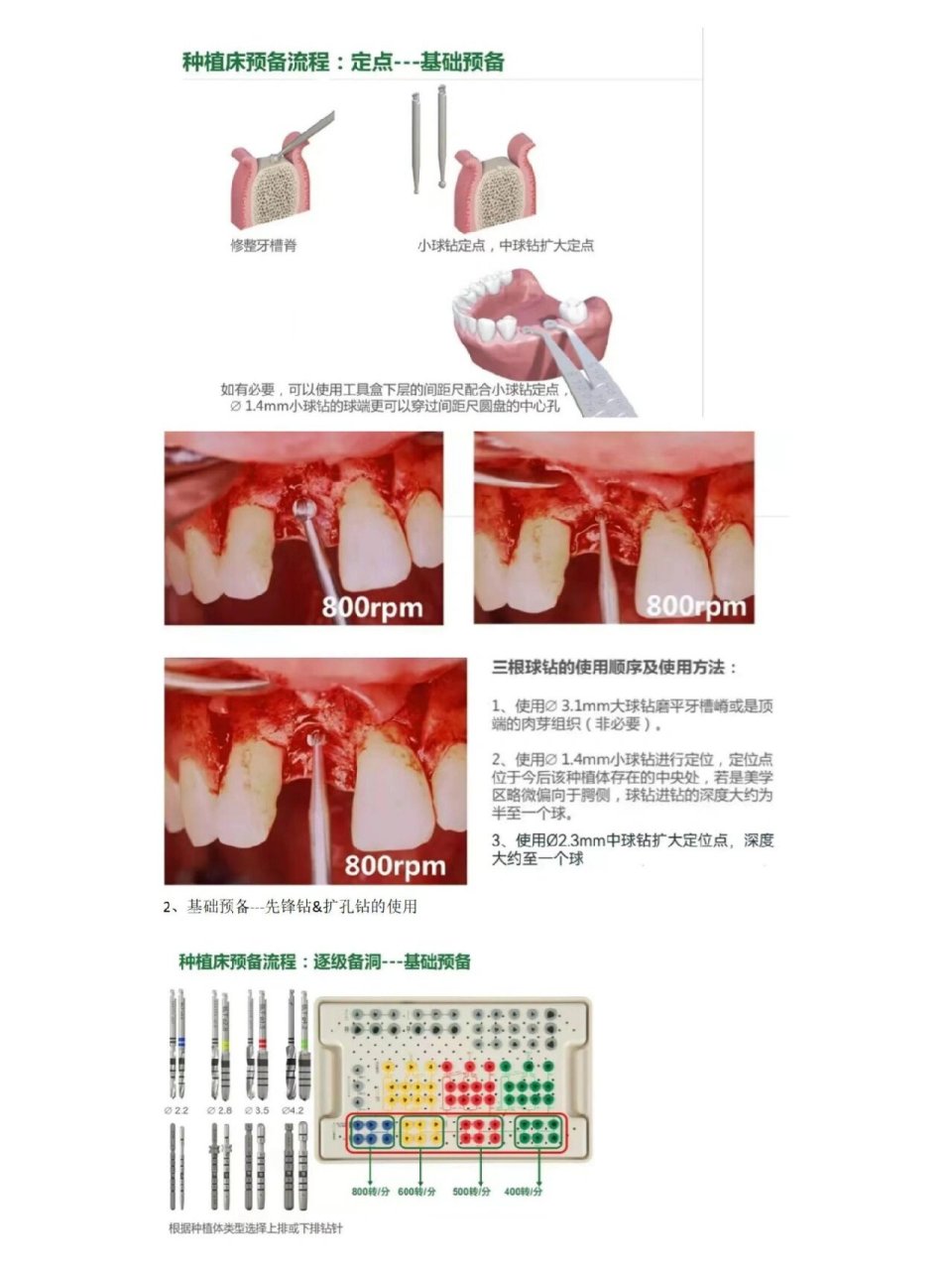 口腔知识—士卓曼种植手术工具盒