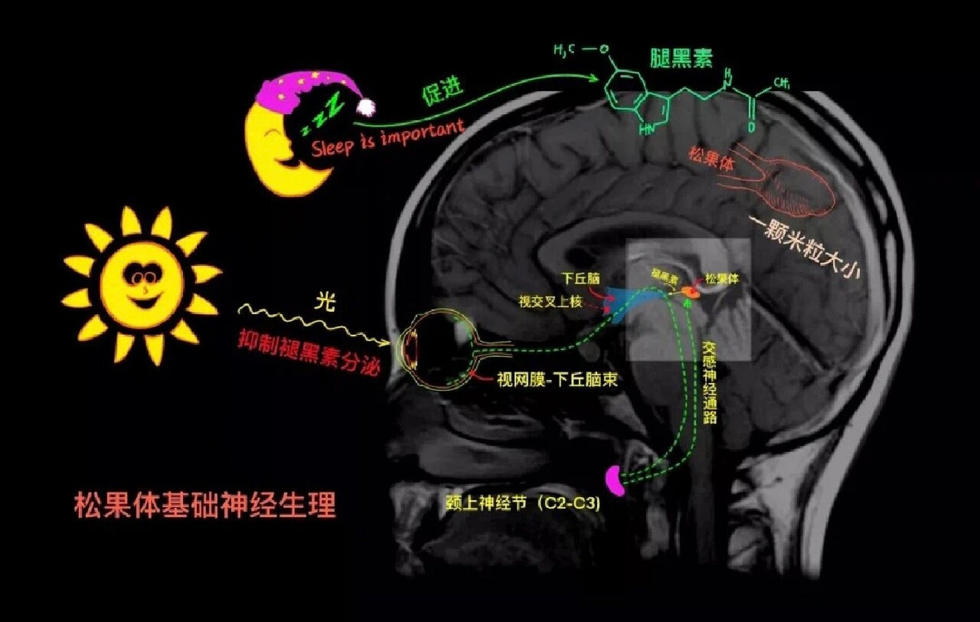 大脑正中矢状面绘图图片