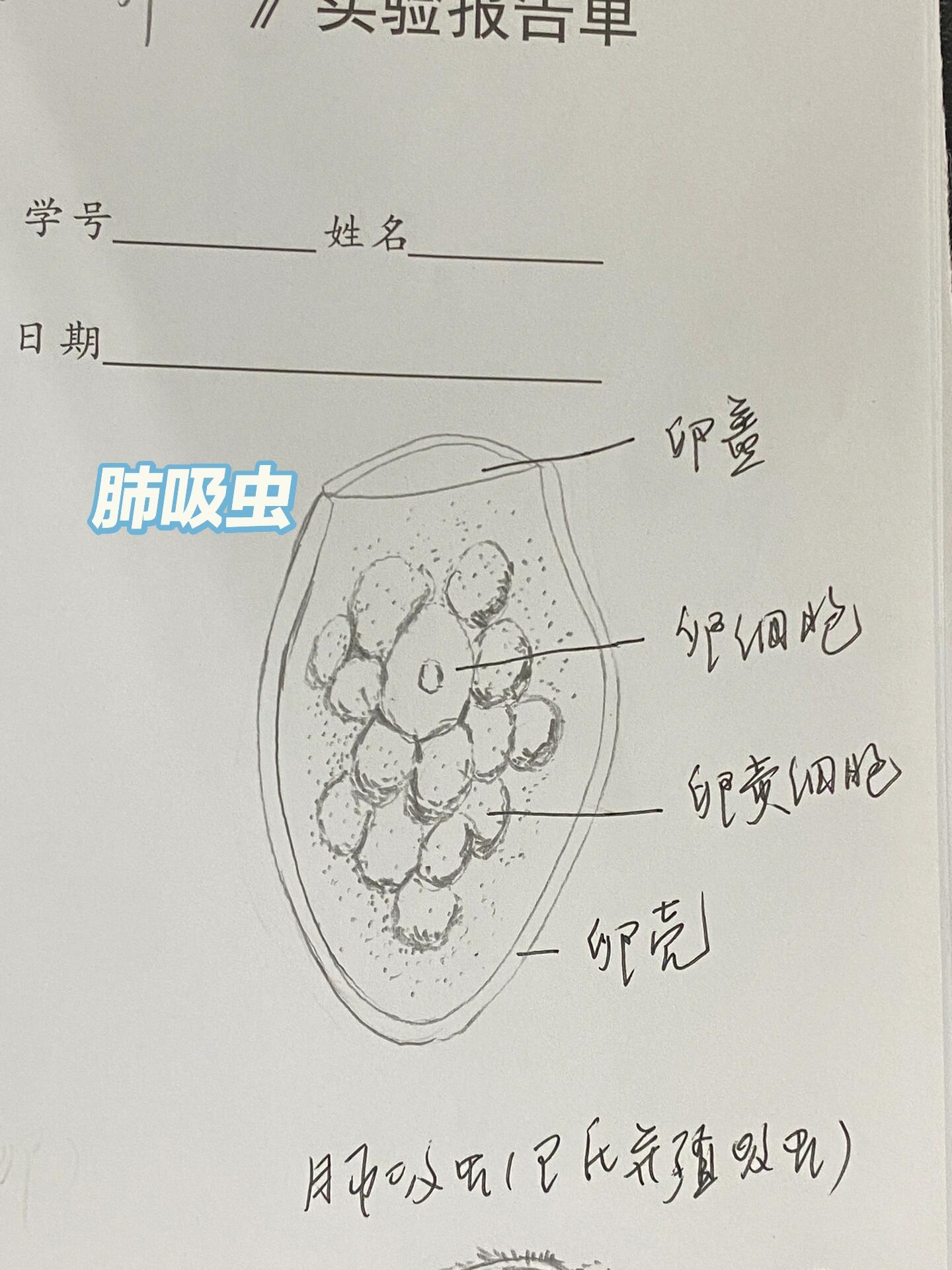 肝片吸虫虫卵手绘图图片