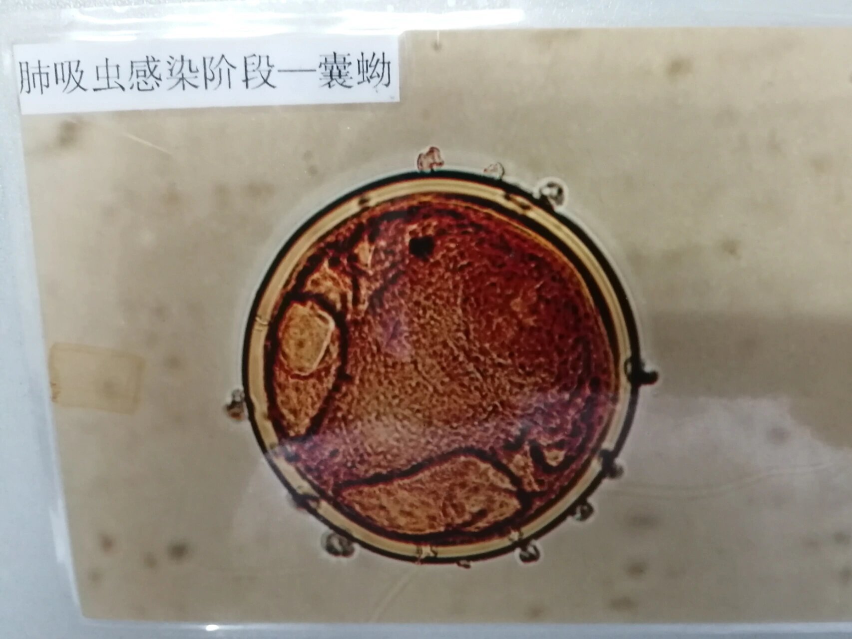 寄生虫形态学-肺吸虫       肺吸虫卵 椭圆形,大小约80-118×48-60μm